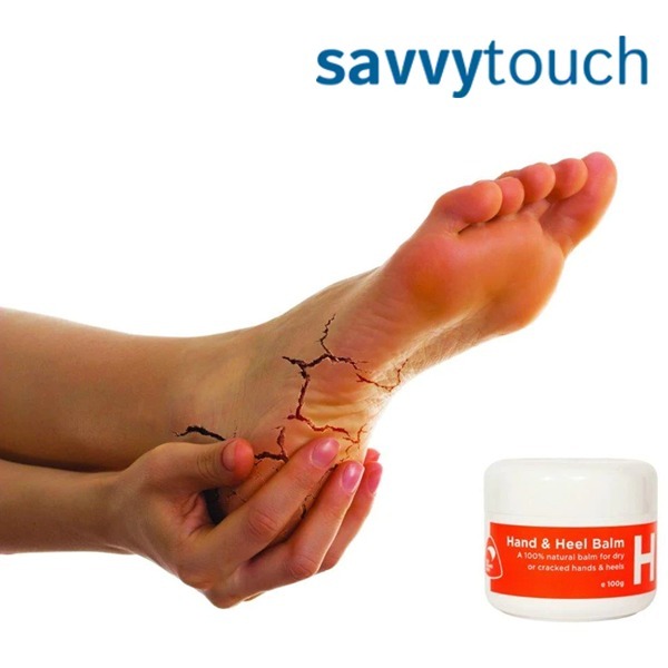 Savvy Touch Hand and Heel Balm for Dry and Cracked Skin 100g