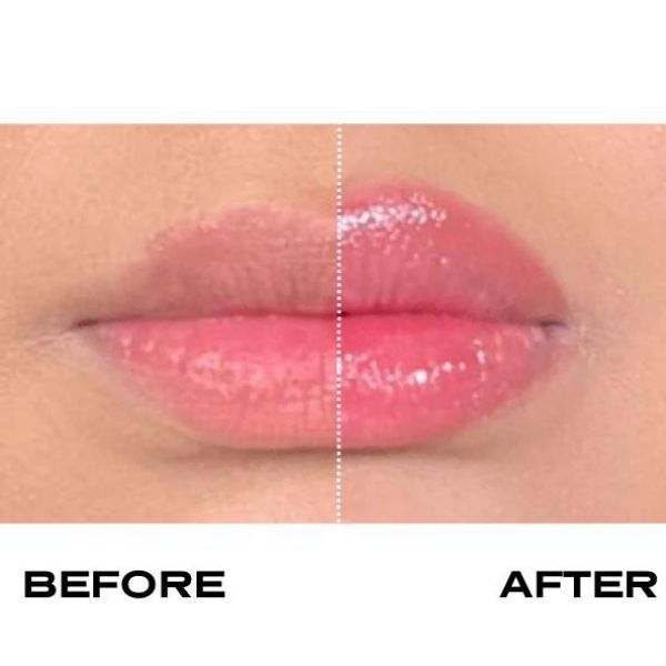 Plump It! No Needles Lip Filler Kit: Extreme