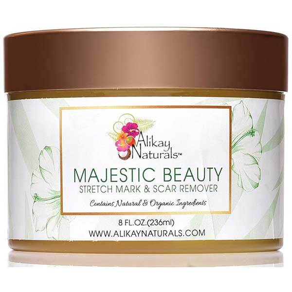 Alikay Naturals Majestic Beauty Stretch Mark & Scar Remover