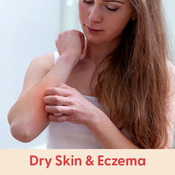 e0826_plp_expert-page-materials-Dry-Skin-Eczema.png
