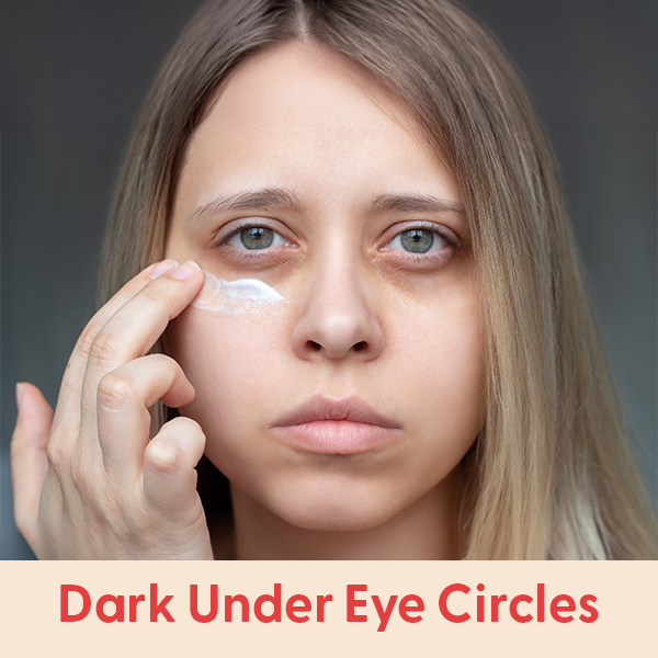 e0826_plp_expert-page-materials-Dark-Under-Eye-Circles.png