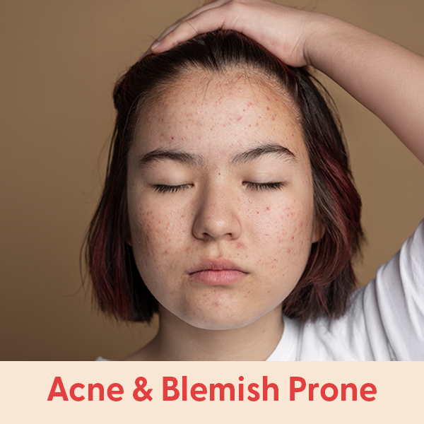 e0826_plp_expert-page-materials-Acne-Blemish-Prone.png