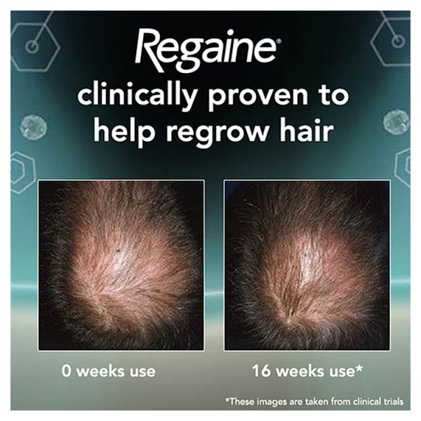 Regaine For Men Foam Hair Re-Growth with Minoxidil 1 x 73ml