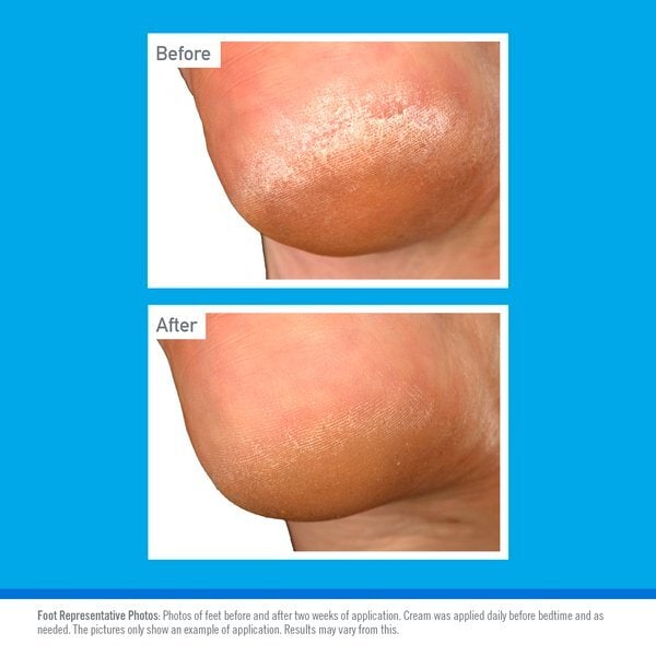 O'keeffe's Healthy Feet Overnight 80Ml