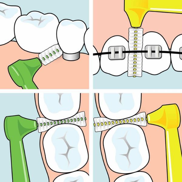 Tepe Angle Interdental Brush Yellow