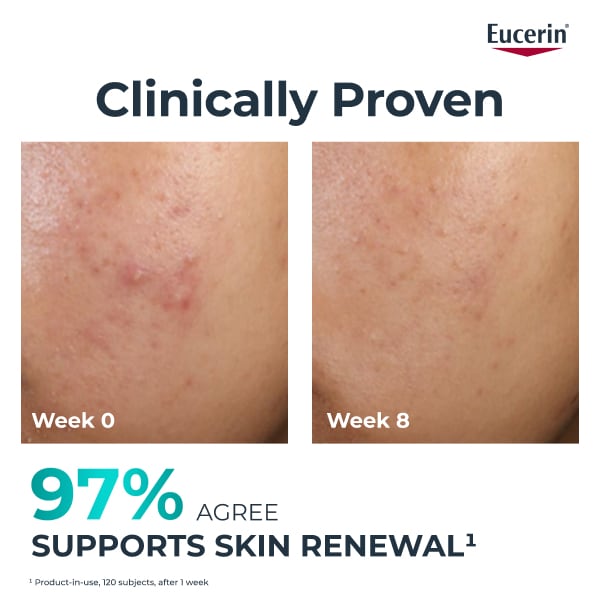Eucerin Dermopure Clinical Peeling 10 Treatment 40ml