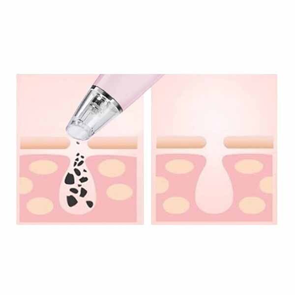 DNR MAGNITONE PorePatrol Skin Renewing Extraction System