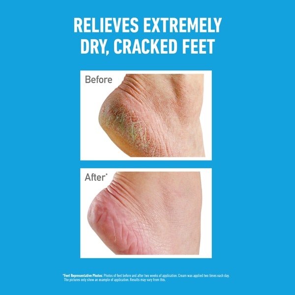 O'Keeffe's Healthy Feet 85g Tube
