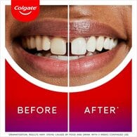 Colgate Max White Ultimate Renewal Whitening Toothpaste 75Ml