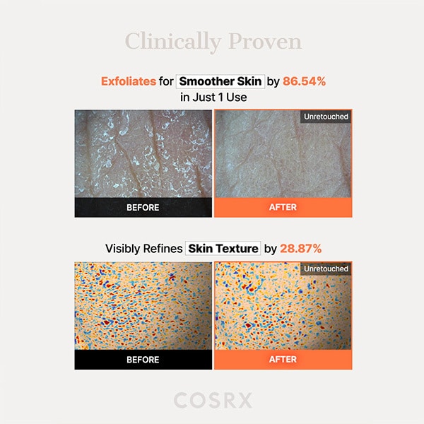 5 Pdrn Hyaluronic Acid Vital Hydrating Hydrogel Mask_3Ea
