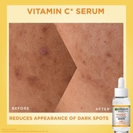 Vitamin C* Duo  Brightening Serum & Spf 50+ Set