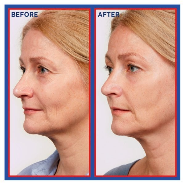 L'Oreal Paris Revitalift Laser Pure Retinol Night Serum 30ml