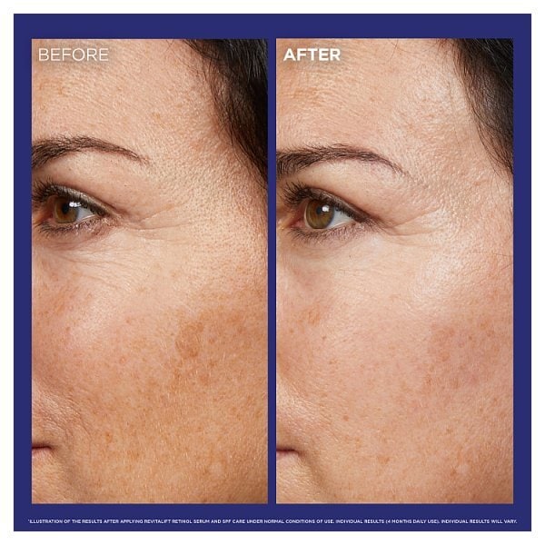 L'Oreal Paris Revitalift Laser Pure Retinol Night Serum 30ml