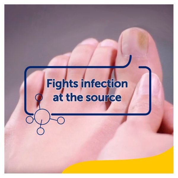 Scholl Fungal Nail Treatment Kit 3.8 ML