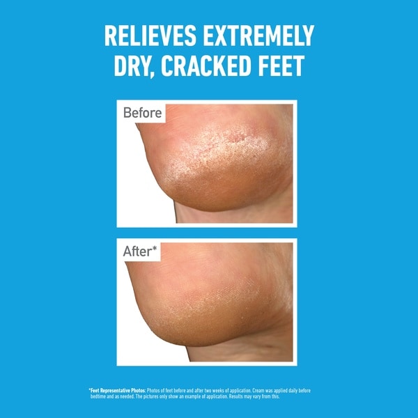O'keeffe's Healthy Feet Overnight 80Ml