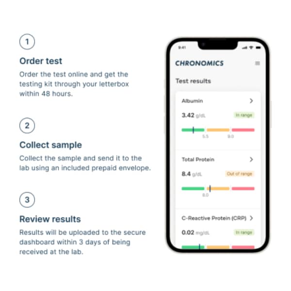 Prostate Health (Psa) At Home Lab Test