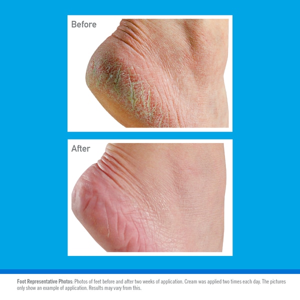 O'Keeffes Healthy Feet Tube 60g