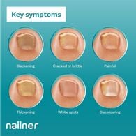 Nailner Active Cover Nail Fungus Treatment Natural Nude