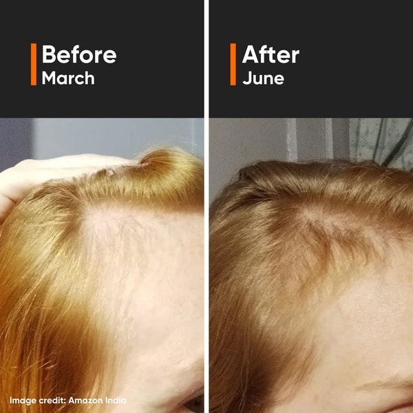Minimalist Hair Density Serum 18% Hair Serum 30ML
