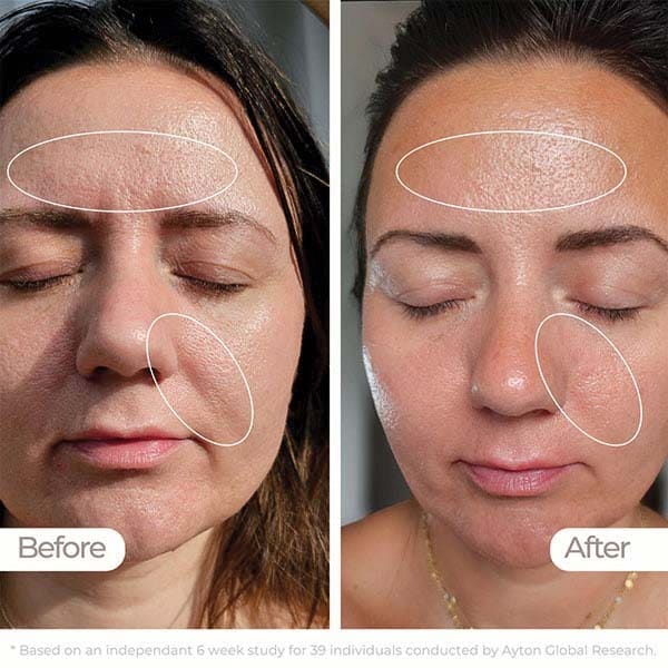 STYLPRO LED Face Mask