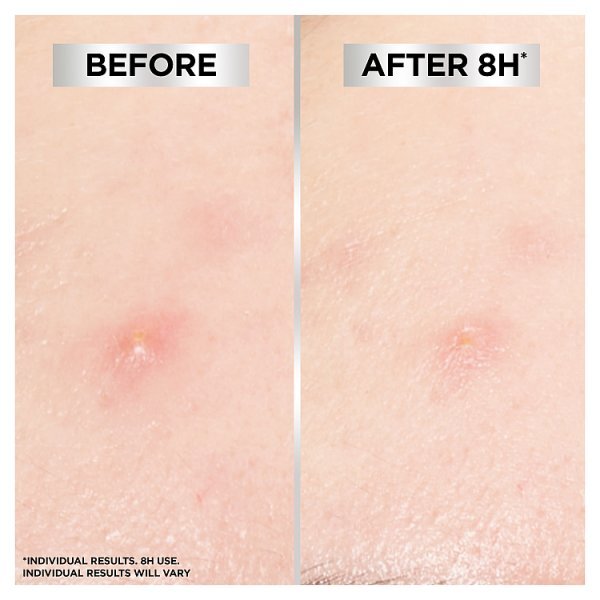 Garnier Blemish Patches Ultra-thin & Invisible Reduce the Appearance of Spots in 8H 22 Patches