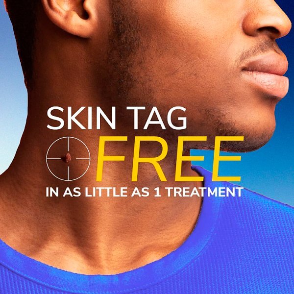 Scholl Freeze Away Skin Tag Remover