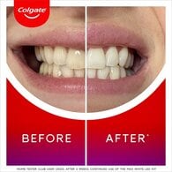 Colgate Max White LED Whitening Kit