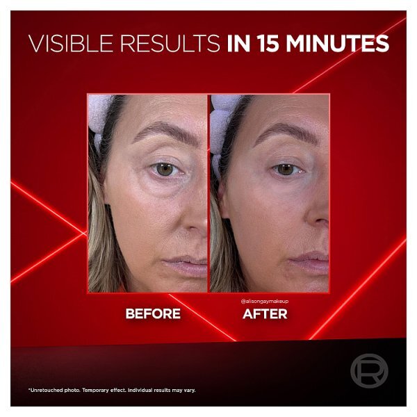 L'Oréal Paris Revitalift Laser Eye Bag Eraser 15ml