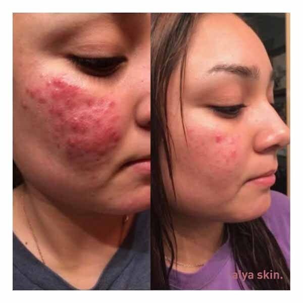 Alya Australian Pink Clay Mask 120Ml