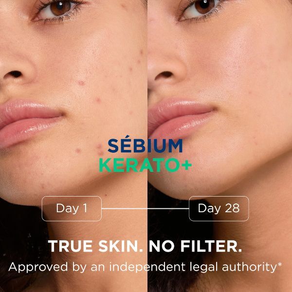 Bioderma Sebium Kerato+ Gel Cream For Acne Prone Skin 30Ml