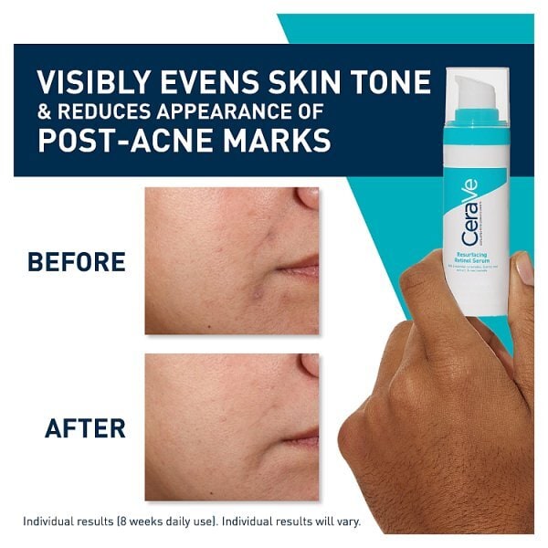 CeraVe Retinol Serum with Niacinamide for Blemish-Prone Skin 30ml