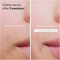 Braun Silk·expert Pro 5 PL5124 Latest Generation IPL