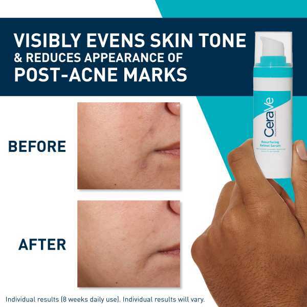 CeraVe Retinol Serum with Niacinamide for Blemish-Prone Skin 30ml