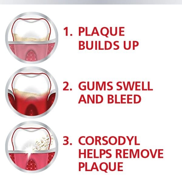 Corsodyl Gum Treatment Mouthwash Chlorhexidine 0.2% Mint