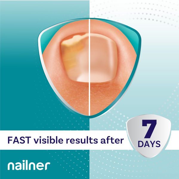 Nailner 2in1 Brush 5ml