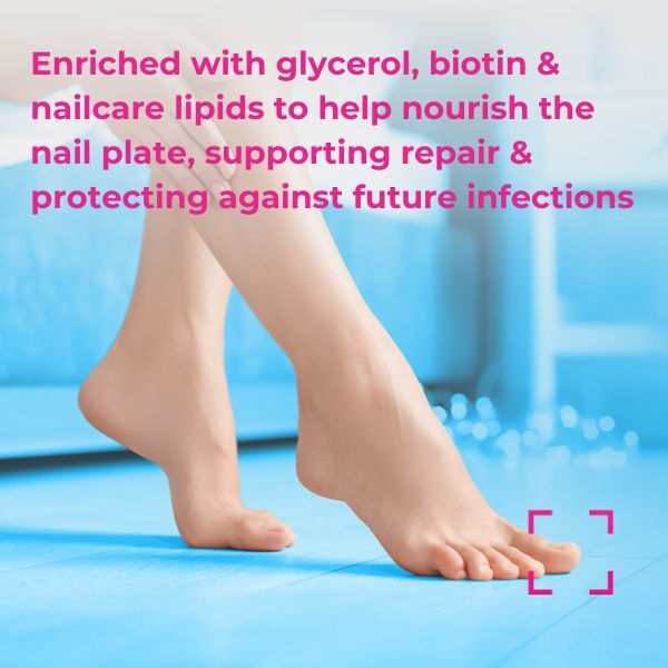 Excilor Ultra Nail Fungus Treatment