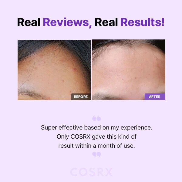 DNR Cosrx Aha/Bha Clarifying Treatment Toner 150Ml