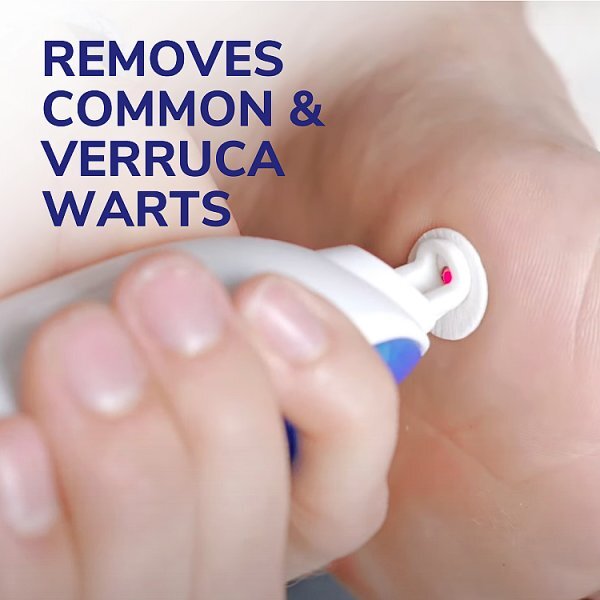 Dr. Scholl's Freeze Away Max Wart & Verruca Remover