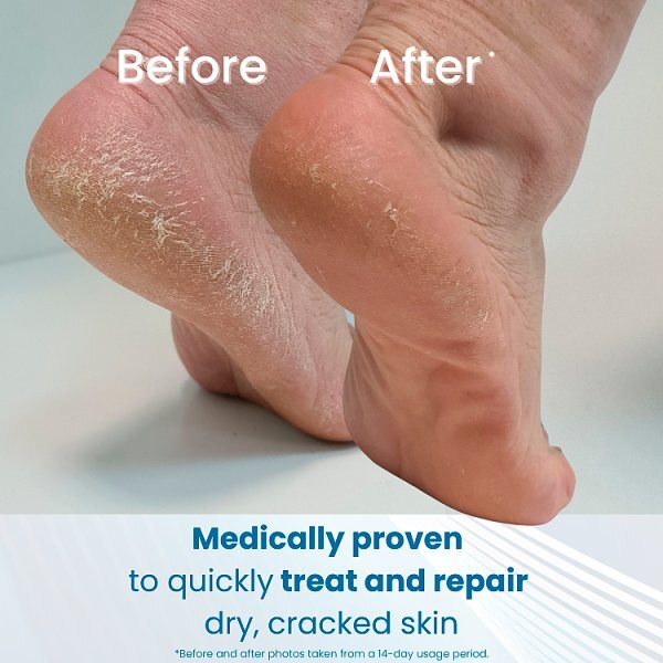 Flexitol Cracked Heel Balm 112G