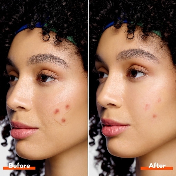 Biore 15G Paint And Peel Pimple Patch