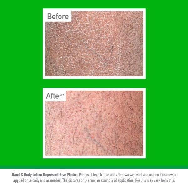 O'keeffe's Working Hands Hand And Body Lotion