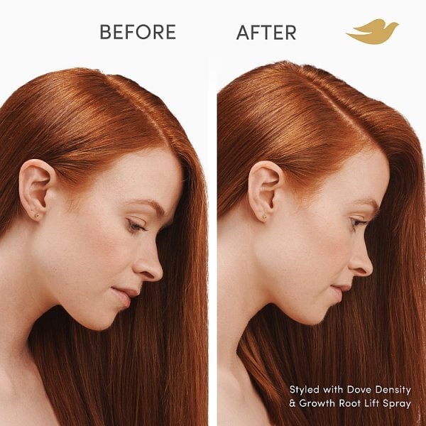 Dove Hair Scalp Therapy And Growth Root Lift Spray 100Ml