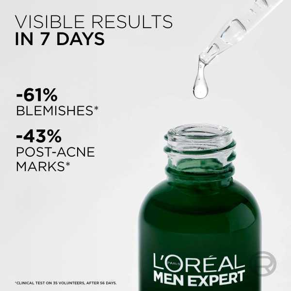 L'Oreal Men Expert Derma Control Anti-Blemish Serum 3% Niacinamide