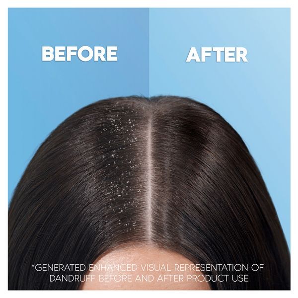 DNR Head & Shoulders Hair Shampoo Refillable Bottle, 480ml