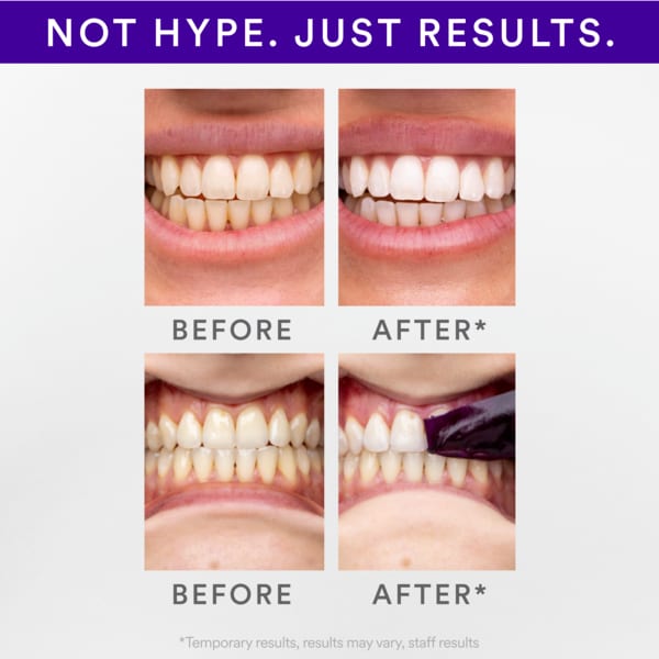 Hismile V34 Teeth Whitening Strips (14Pk)