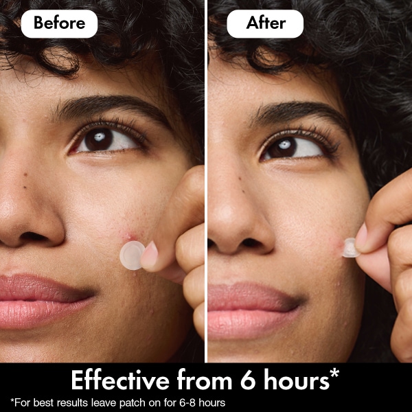 Hero Mighty Patch Mini Invisible Pimple & Acne Patches 30Ct