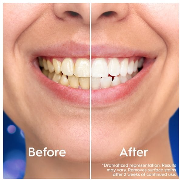 Oral-B Intensive Whitening Radiant White Toothpaste 75ml