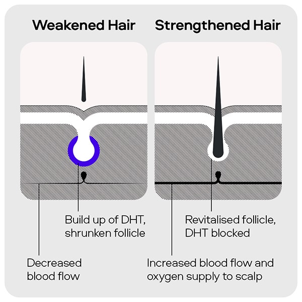 Sons Shampoo for Male Pattern Hair Loss 200ml