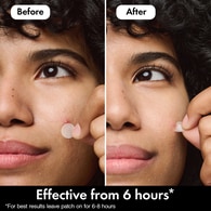 Hero Mighty Patch Mini Invisible Pimple & Acne Patches 30Ct