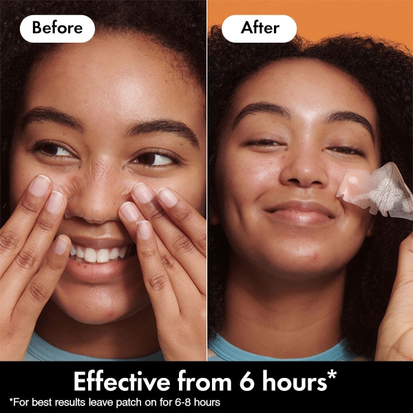 Hero Mighty Patch Nose Hydrocolloid Pimple Patches 10Ct